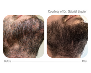 CELLBOOSTER® HAIR