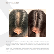 X-O Hair Epiderm-A